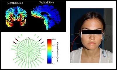 Augmentation of Fear Extinction by Transcranial Direct Current Stimulation (tDCS)